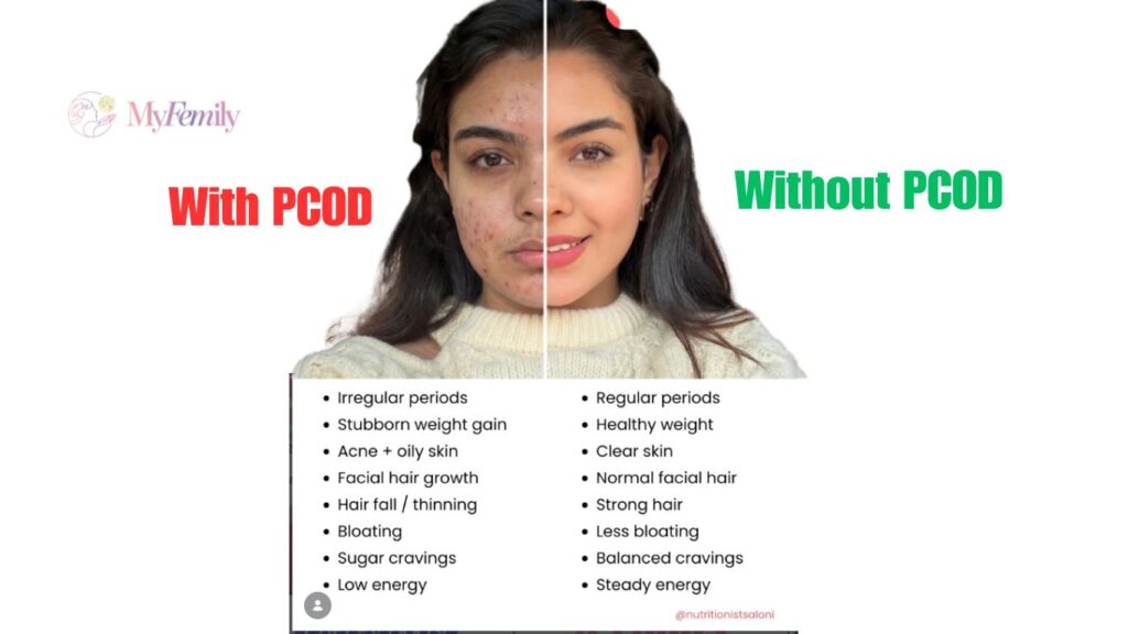 PCOD Effect on Skin